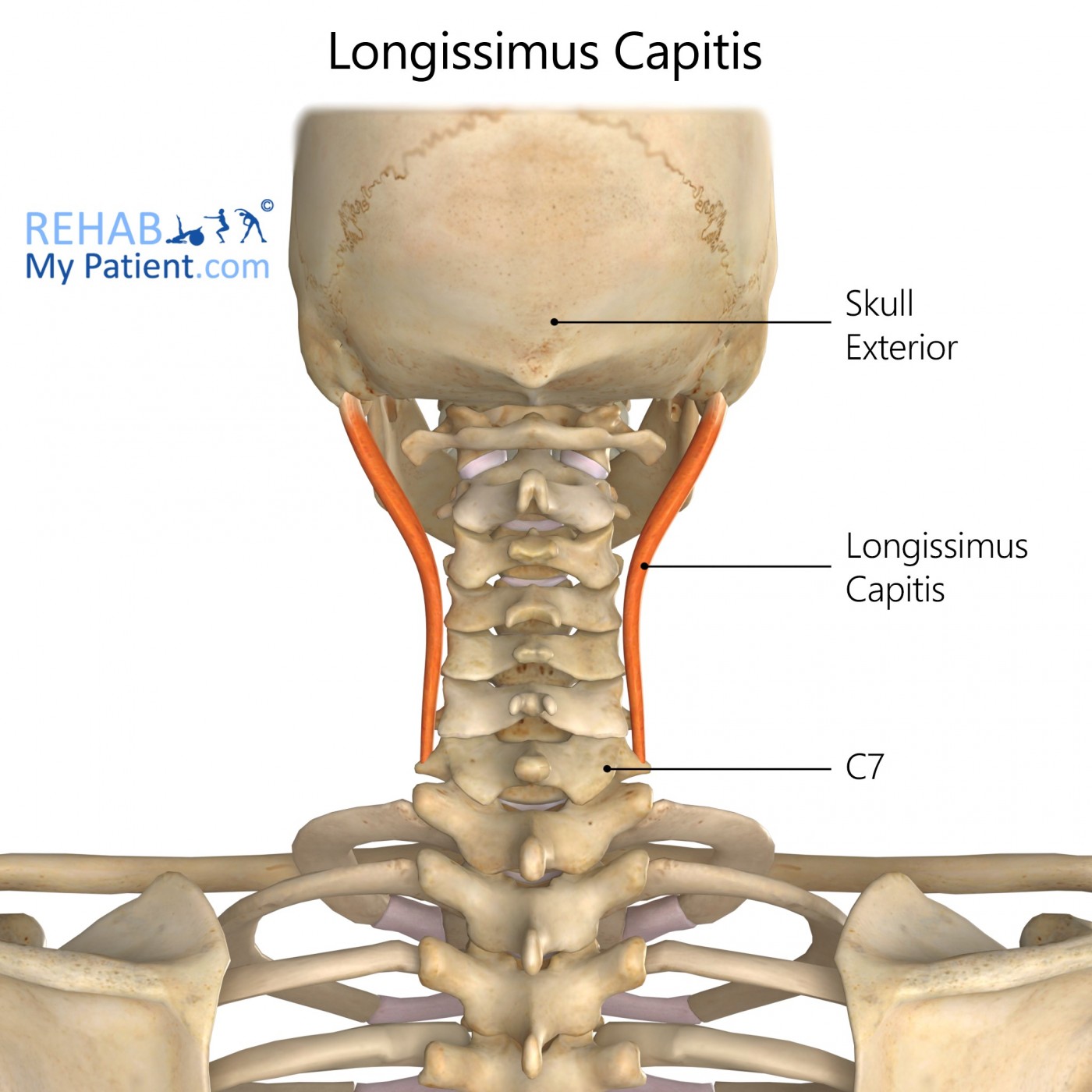 <p><strong>Proximal Attachment</strong></p><p><span>Lower 3 or 4 cervical articular processes</span></p><p><strong>Distal Attachment</strong></p><p><span>Mastoid process</span></p><p><strong>Peripheral Innervation</strong></p><p>posterior rami of spinal nerves</p><p><strong>Action</strong></p><p>Extension, lateral flexion of spine/head</p>