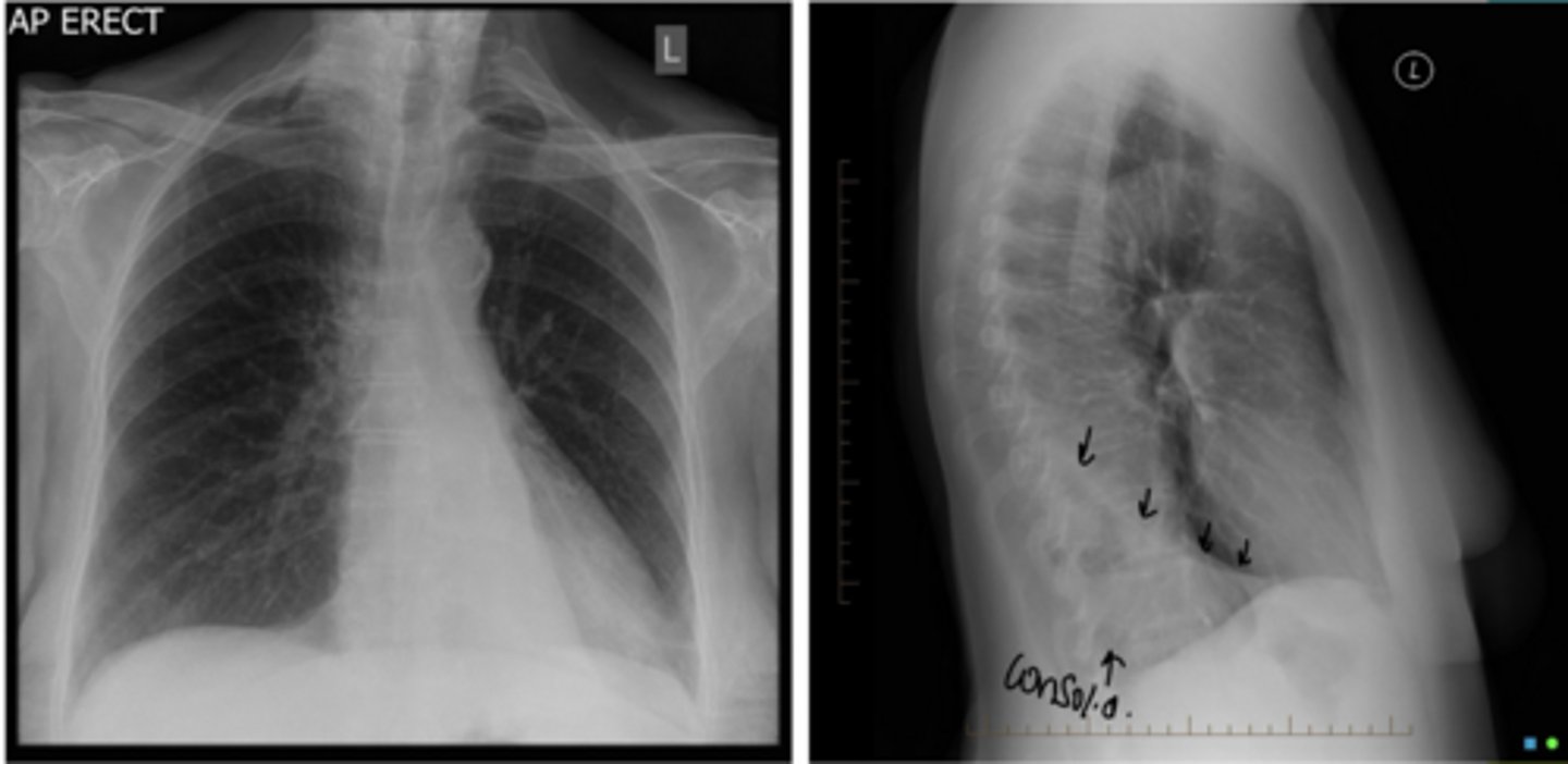 <p>What is the diagnosis?</p>