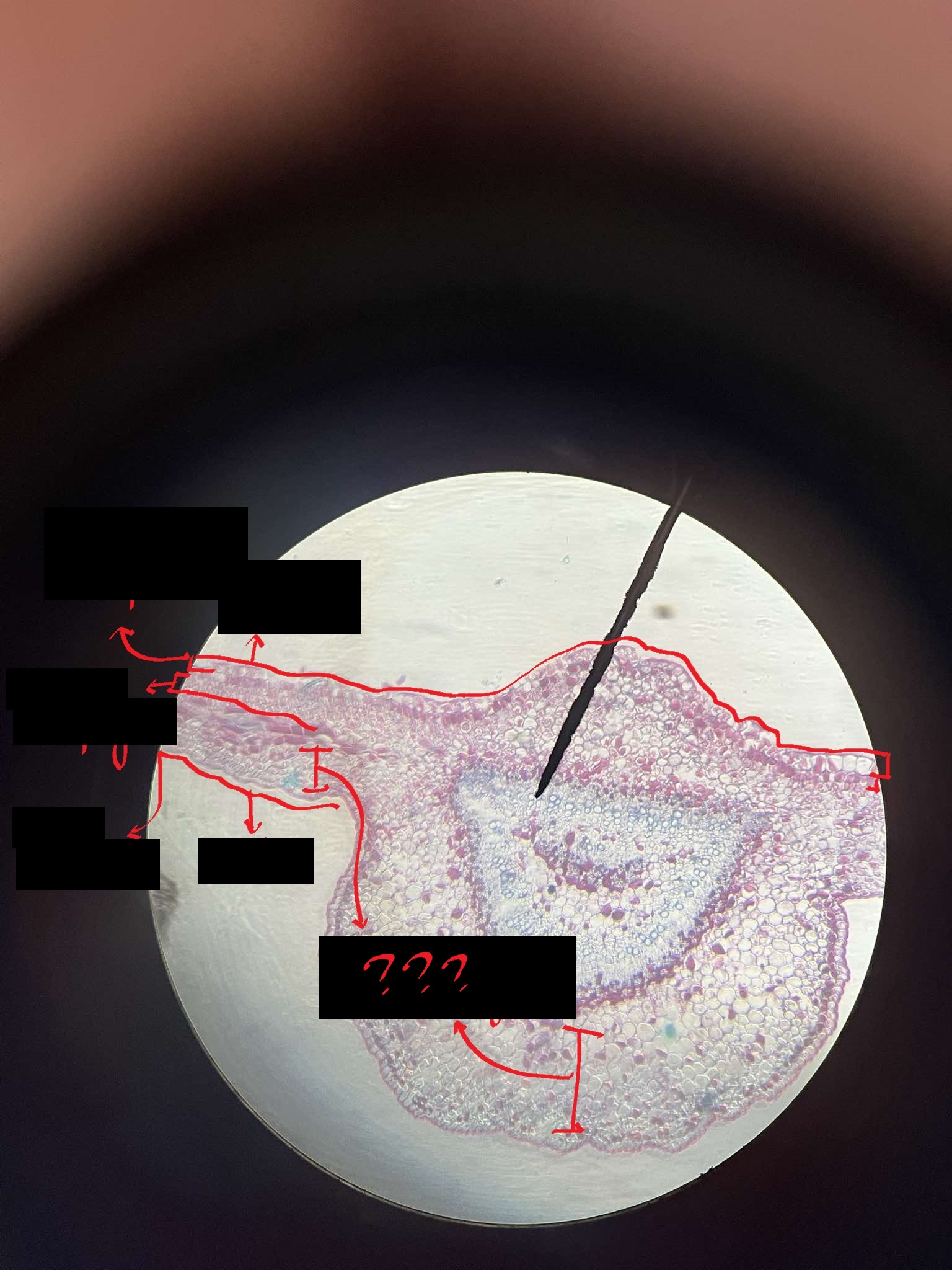 <p>composed of irregular parenchyma with a lot of intercellular spaces; where the stomata are confined</p>