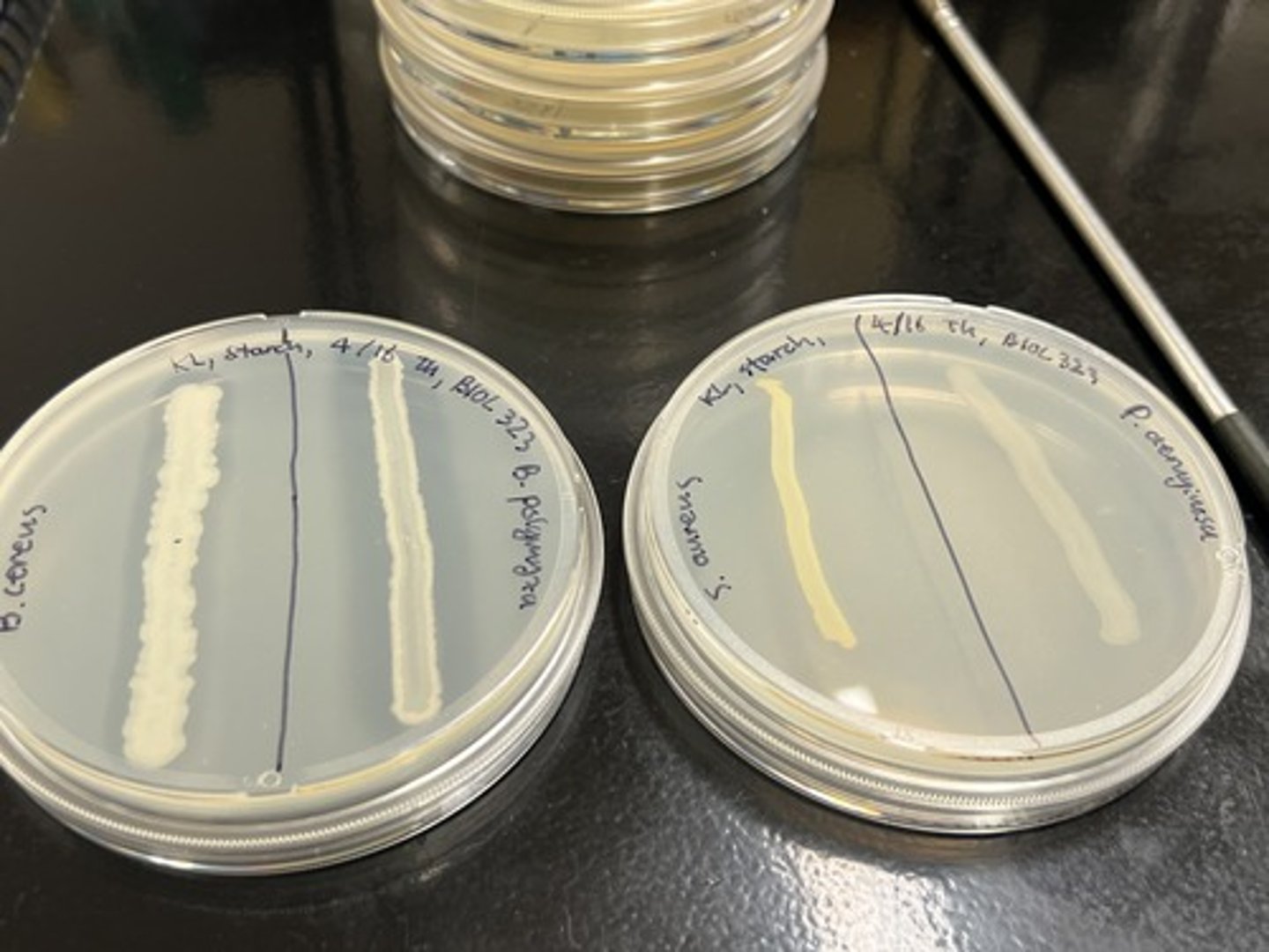 <p>Tests for organisms ability to breakdown starch via the amylase enzyme.</p><p>Ability to use amylase to breakdown starch (+) - Clearing of organism</p>