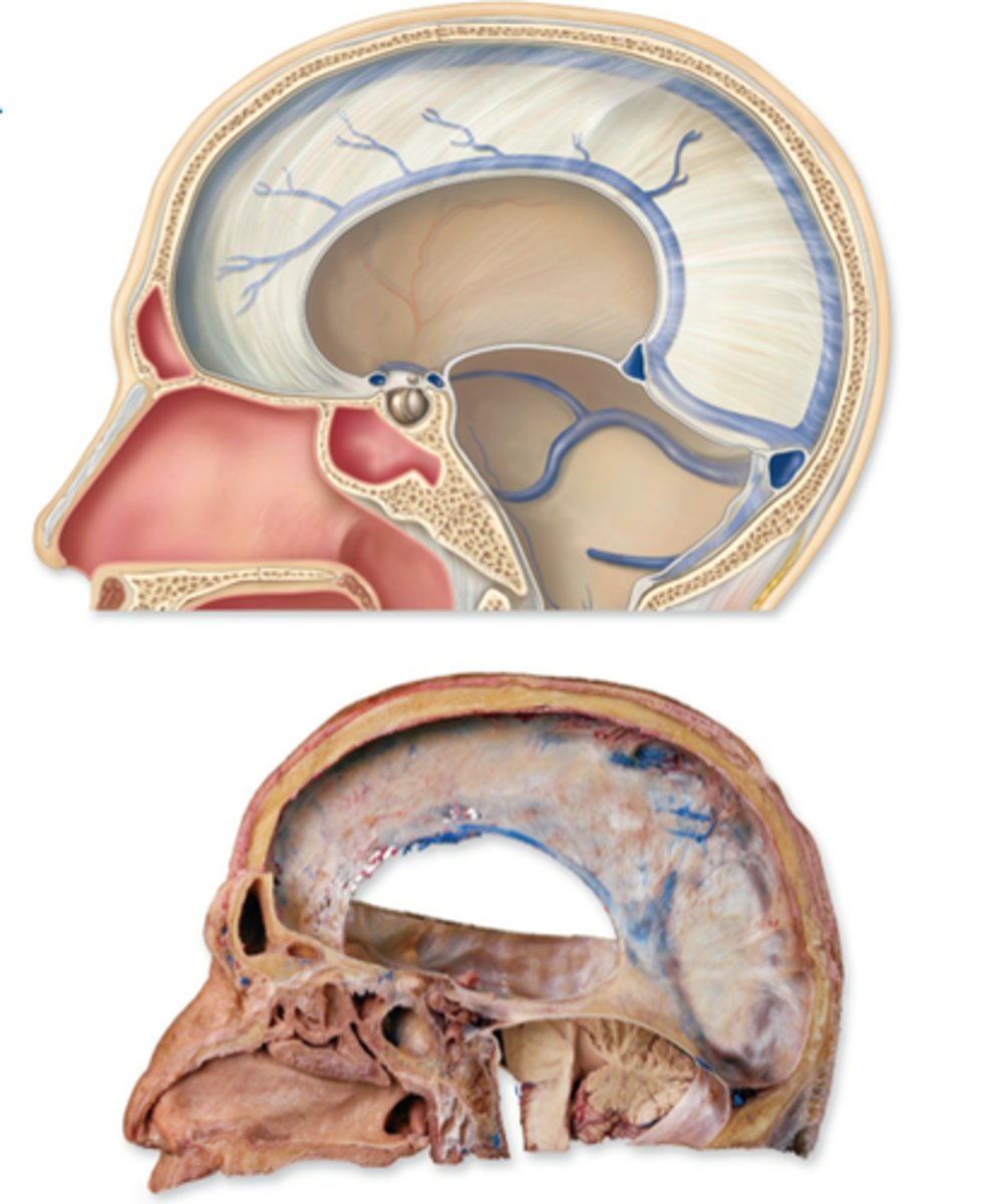 <p>falx cerebri</p><p>tentorium cerebelli</p><p>falx cerebelli</p>