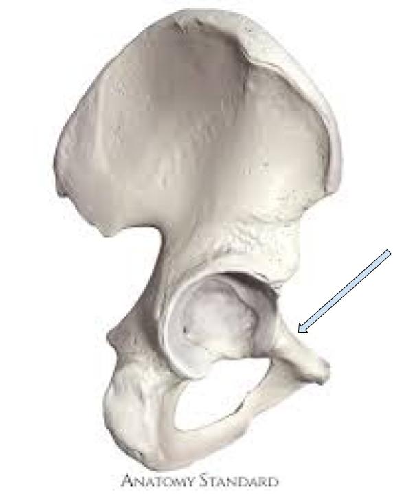 <p>connects Ilium to the pubis, more superior ramus </p>