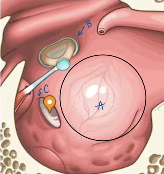 <p>What is the part of the tympanic cavity circled and labeled A?</p>