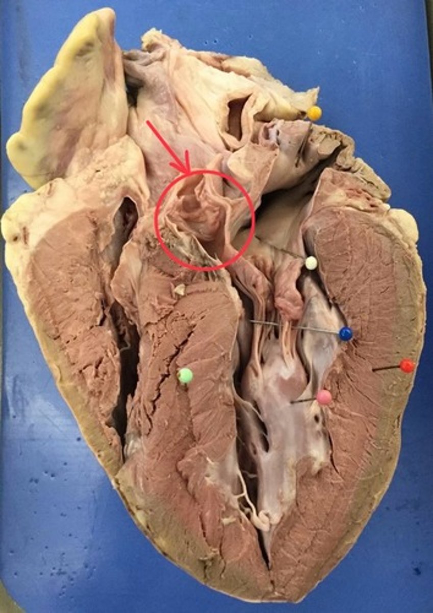 <p>identify this valve</p>