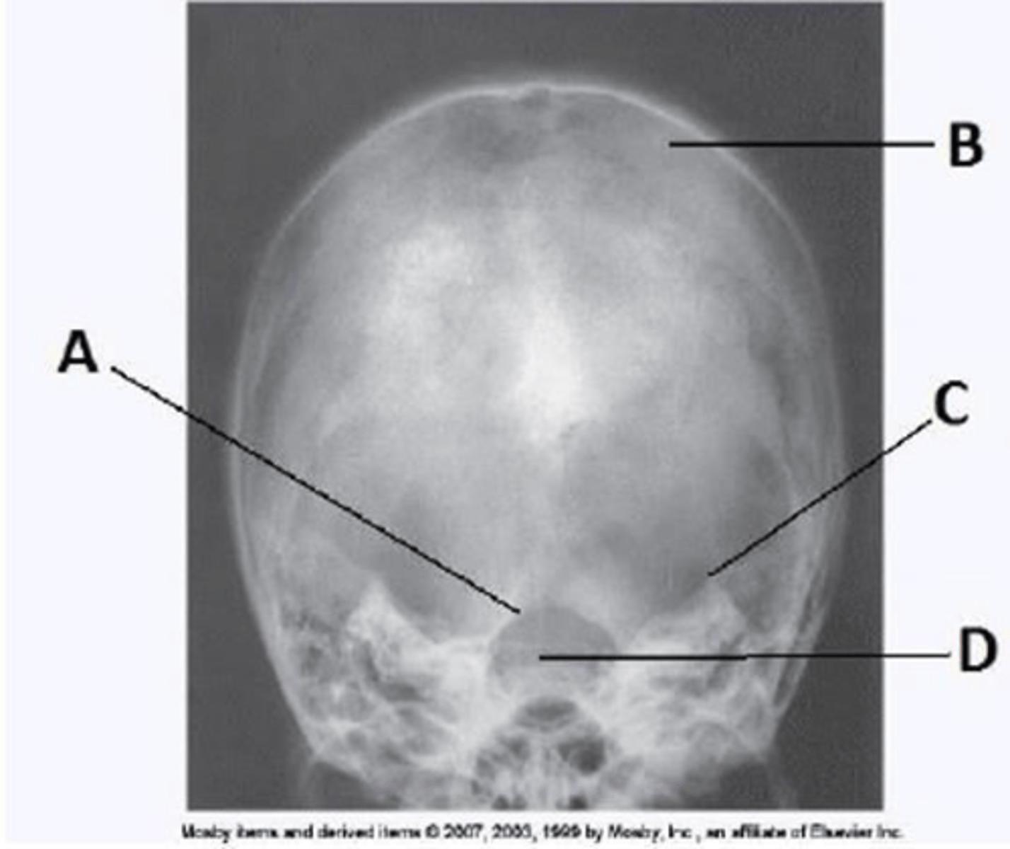 <p>b. foramen magnum.</p>