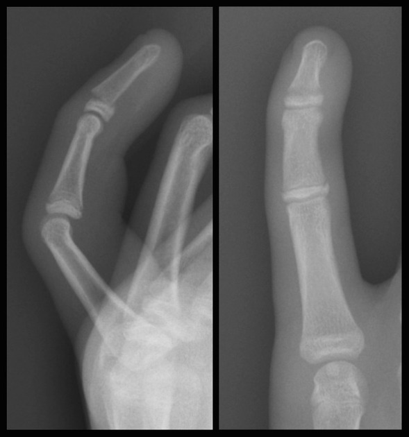 <p>Describe the abnormality demonstrated.</p>