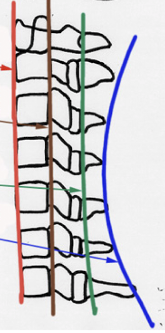 <p>Label these 4 Lines? (C/S)</p>