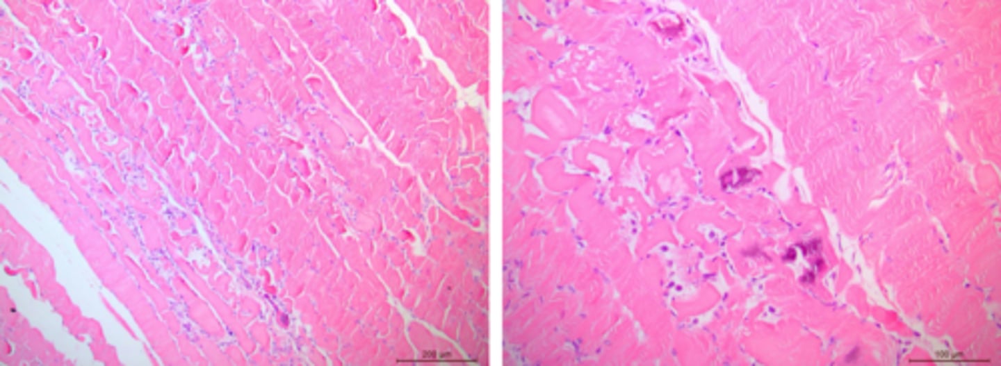 <p>Identify the pathology:</p>