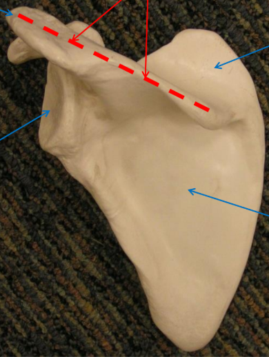 <p>What is the upper right arrow pointing to? </p>