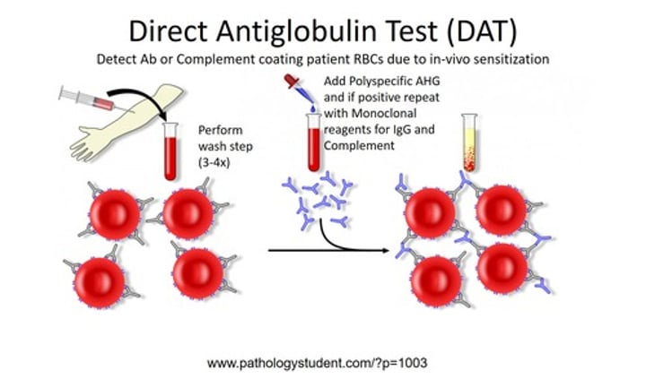 <p>-A patient's RBCs are obtained and washed (3-4x) with physiologic saline</p><p>-Coomb's Reagent is added which will bind to any antibodies present on the RBCs</p><p>-Agglutination will occur if there are antibodies on the RBCs</p>
