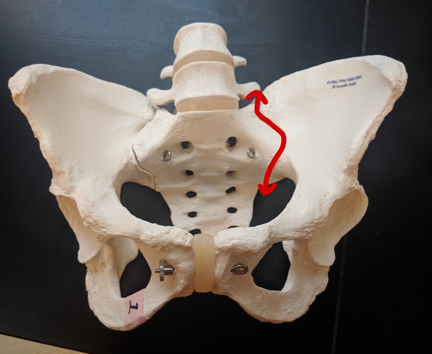 <p>Name this specific articulation</p>