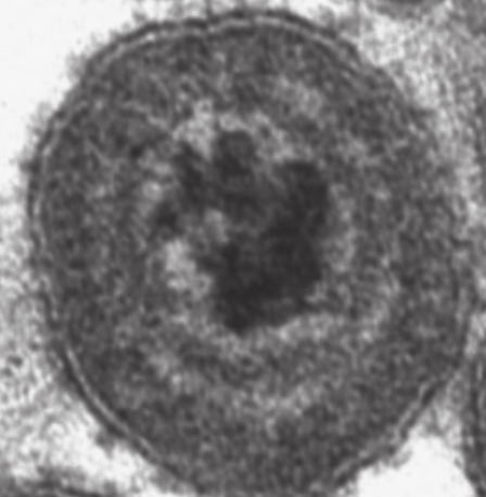 <p>BHV-1 (infectious bovine rhinotracheitis; IBR)</p>