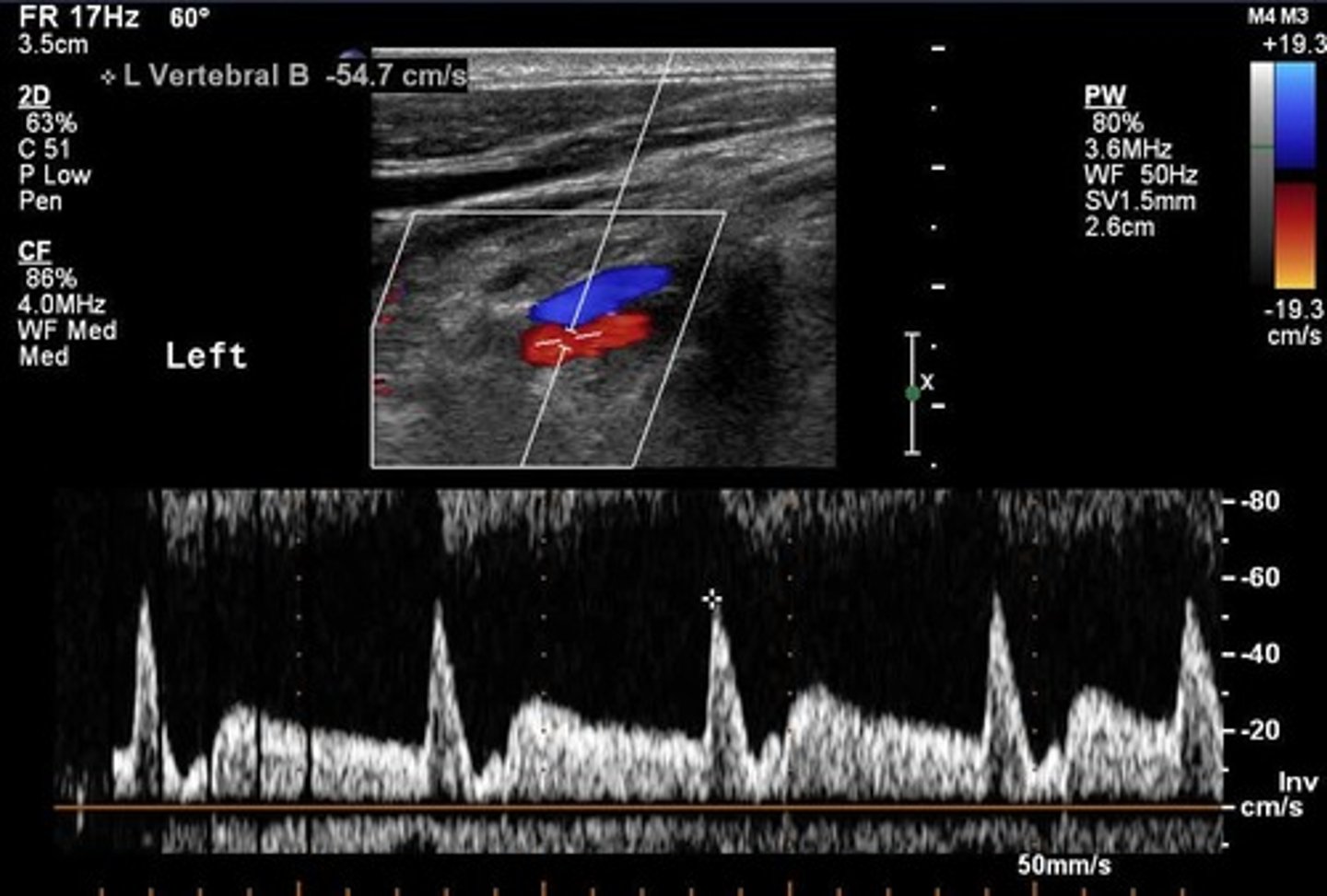 <p>the planet's minimum mass and sometimes info about the orbital period and distance</p><p>Why?</p><p>- a planet's gravity makes its star "wobble"</p><p>- the size of that wobble depends on how big the planet is</p>