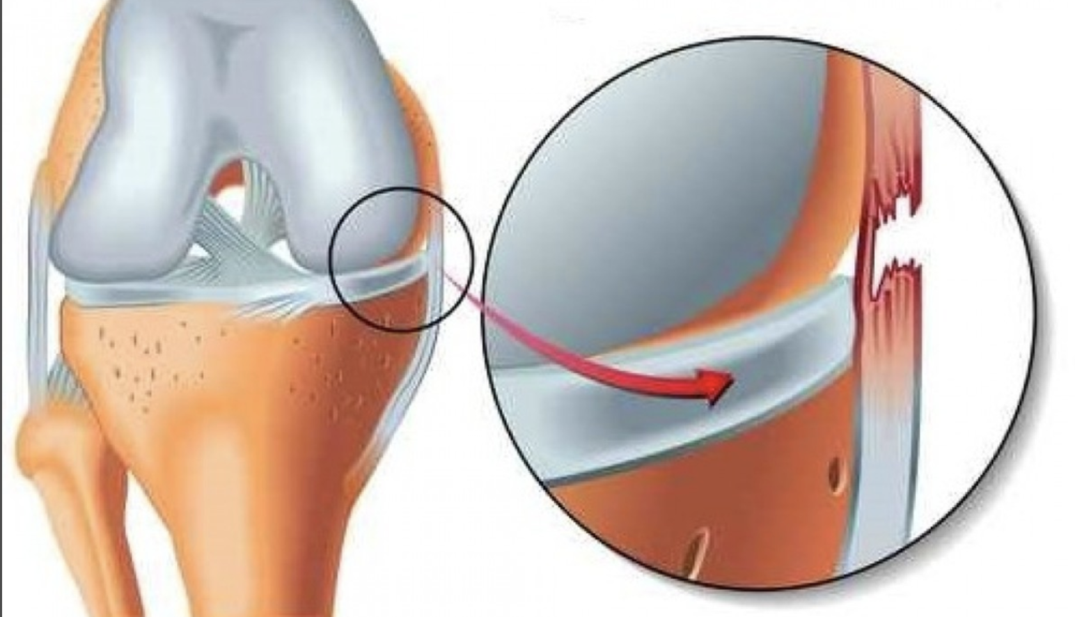 what injury is this?
