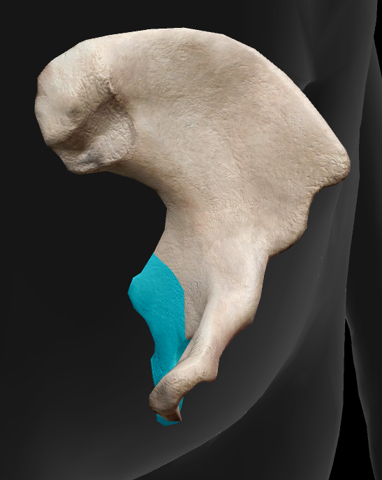 term image