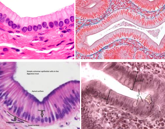 <ul><li><p>Characteristic: <strong>COLUMN-SHAPED CELLS</strong> and the <strong>NUCLEI IS ON ONE END OF THE CELL</strong> (it’s not in the middle)</p></li><li><p>Location: <strong>DIGESTIVE TRACT</strong> and <strong>FALLOPIAN TUBES</strong></p></li><li><p>Function:</p><ul><li><p>In the <strong>digestive tract </strong>it, MAKES LUBRICATING MUCUS (via goblet cells) and <strong>PROTECTS LINING FROM ACID AND ABRASION</strong></p></li><li><p><strong>In </strong>In the <strong>respiratory tract</strong>, <strong>MUCUS TRAPS MICROBES</strong></p></li><li><p>In the <strong>fallopian tubes</strong>, <strong>CILIA MOVES EGGS</strong></p></li></ul></li></ul><p></p>