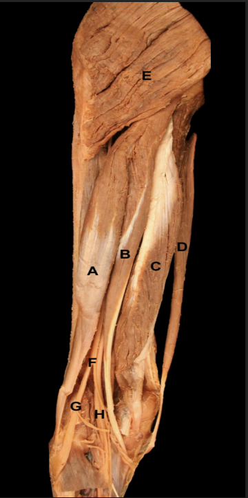 <p>Identify the muscles of the <strong>Posterior Region</strong> of the thigh </p>
