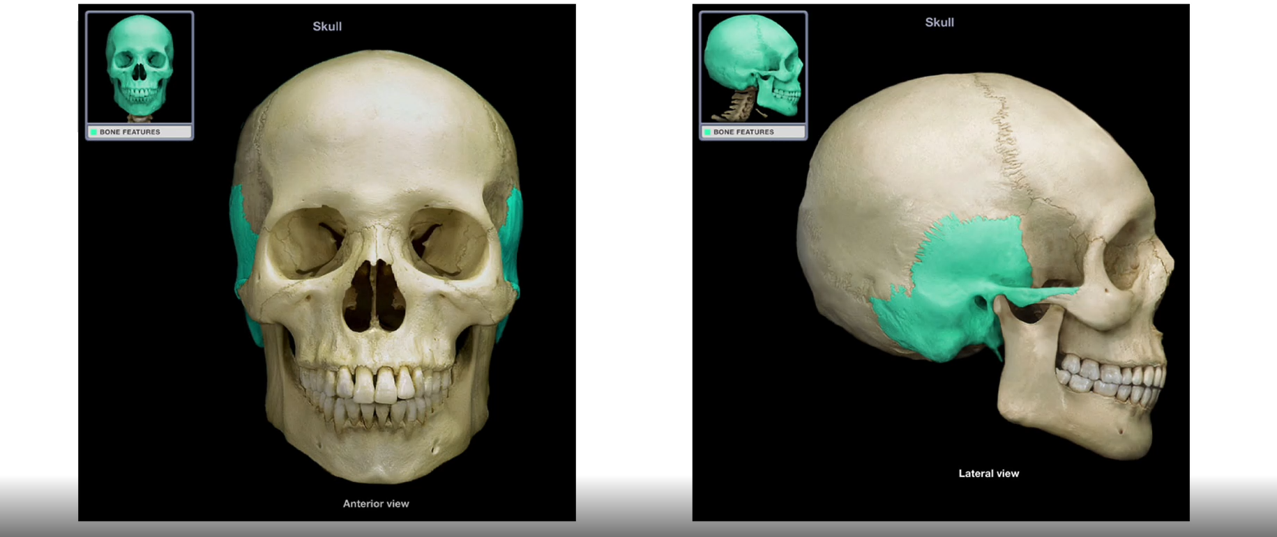 <p>Temporal Bones </p>