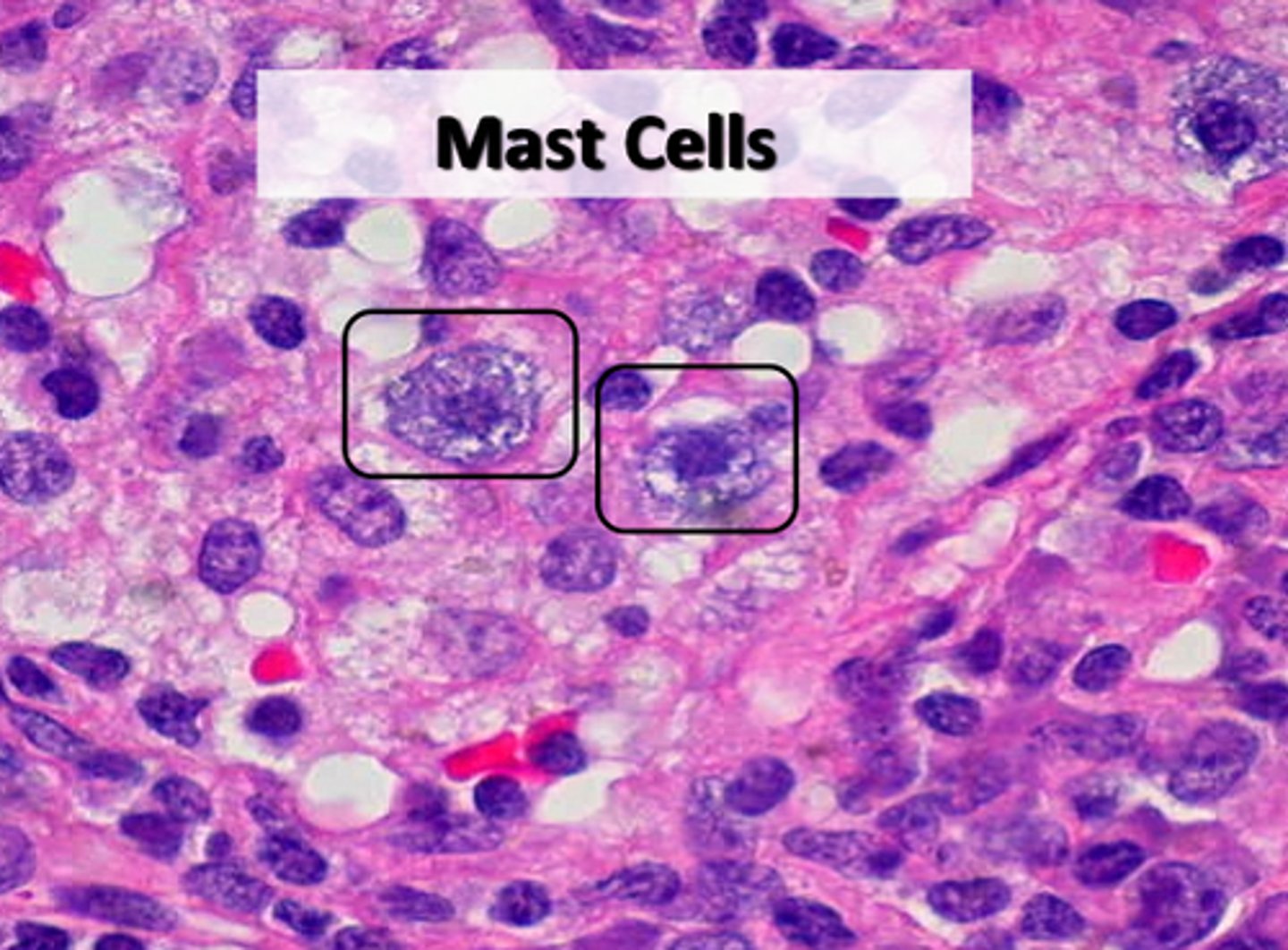 <p>small, mobile cells found near blood vessels; secrete histamine and heparin to stimulate local inflammation in response to injury/infection</p>
