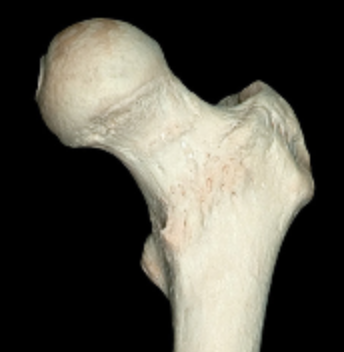 <p>end of femur that articulates with acetabulum </p>