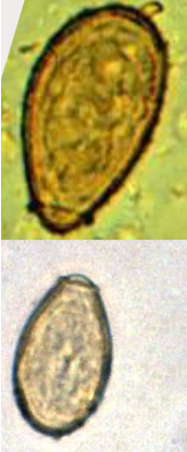 <ul><li><p>27-35 um x 11-20 um</p></li><li><p>Shouldered operculum &amp; abopercular knob</p></li><li><p>Embryonated</p></li></ul><p></p>