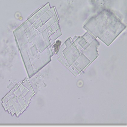 <p>Abnormal</p><ul><li><p>Acidic urine</p></li><li><p>soluble in chloroform, ether</p></li><li><p>Polarization!!</p></li><li><p>flat plates</p></li><li><p>Rare - usually caused by refrigeration</p></li></ul><p></p>