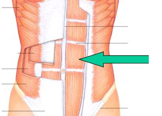 <p>flexes abdomen</p>