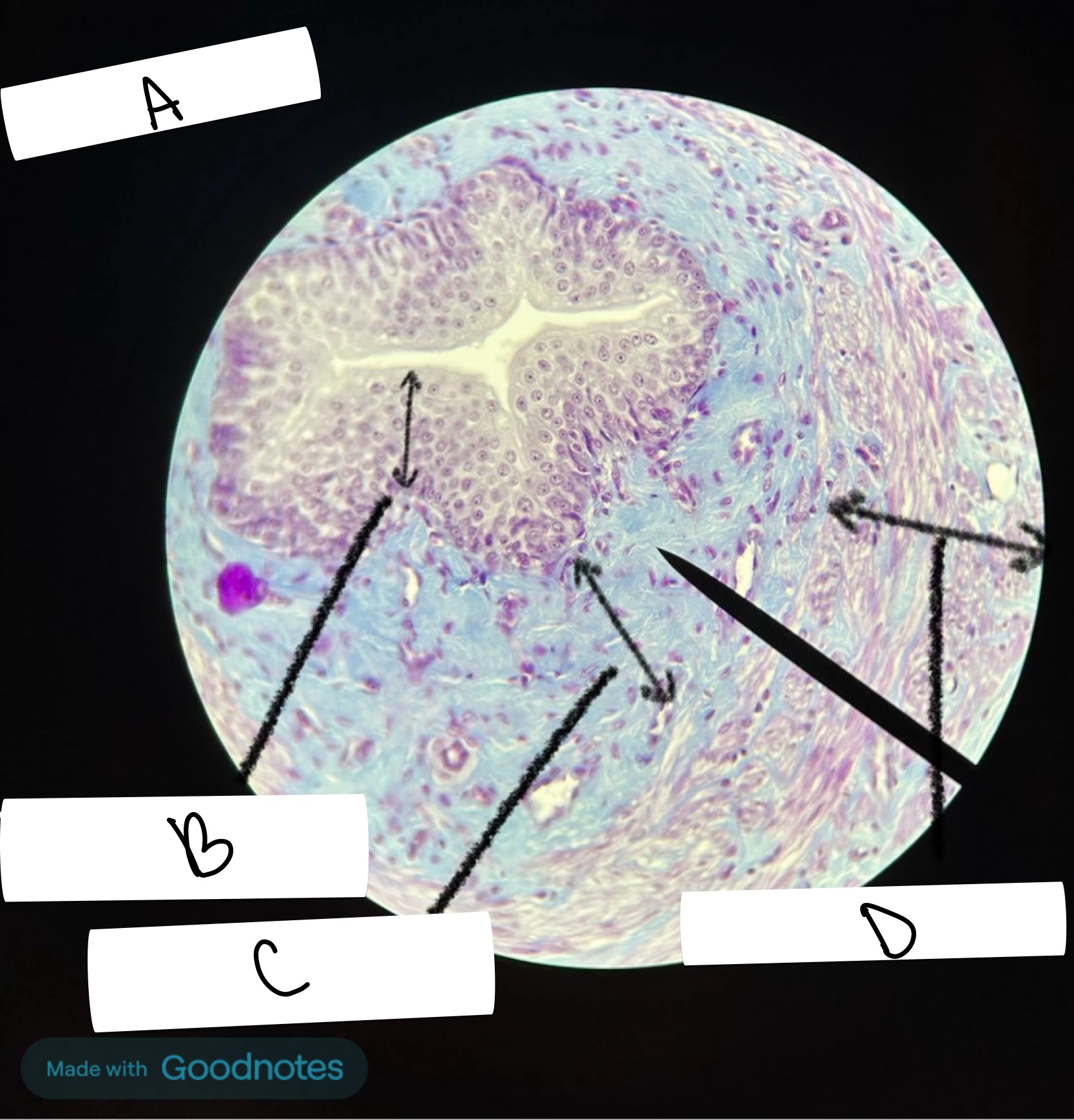 <p>What part of this slide is labeled B</p>