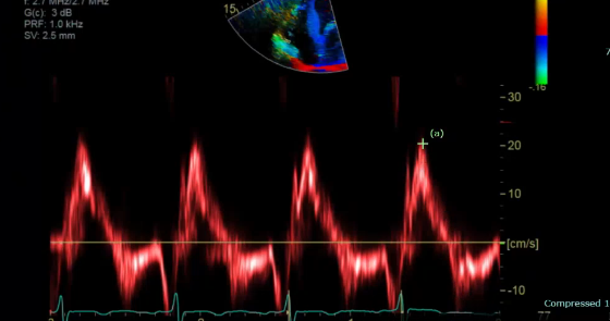 <p>what is the measuring </p>