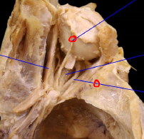 <p>Enters orbit via <strong>Superior Orbital Fissure</strong></p><p>Divides into a sup/inf division</p>