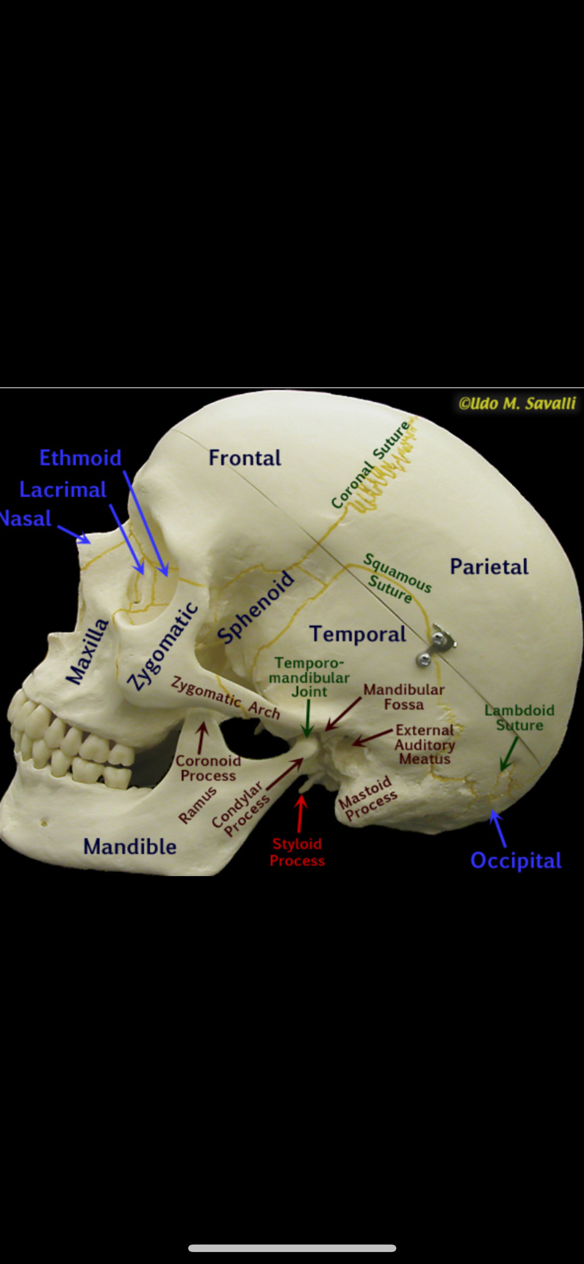 <p><span style="font-family: &quot;Times New Roman&quot;; font-size: 19px;">Thin, triangular projection on the mandible.</span></p><p><span style="font-family: &quot;Times New Roman&quot;; font-size: 19px;">Attachment point for the temporalis muscle (used for chewing).</span></p>