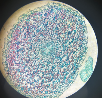 dicot root