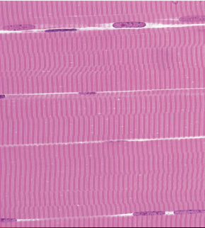 <ul><li><p><span style="background-color: transparent; font-family: "Book Antiqua", serif;"><span>Also called striated and voluntary</span></span></p></li><li><p><span style="background-color: transparent; font-family: "Book Antiqua", serif;"><span>Attached to the skeleton</span></span></p></li><li><p><span style="background-color: transparent; font-family: "Book Antiqua", serif;"><span>Part of the Somatic Nervous System </span></span></p><ul><li><p><span style="background-color: transparent; font-family: "Book Antiqua", serif;"><span>Under voluntary control (PNS)</span></span></p></li></ul></li><li><p><span style="background-color: transparent; font-family: "Book Antiqua", serif;"><span>Striations produced from actin and myosin proteins</span></span></p></li><li><p><span style="background-color: transparent; font-family: "Book Antiqua", serif;"><span>Multinucleated</span></span></p></li></ul><p></p>