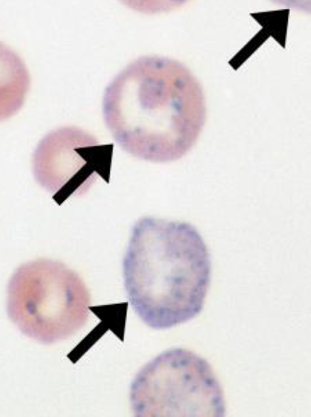 Name this RBC Abnormality.