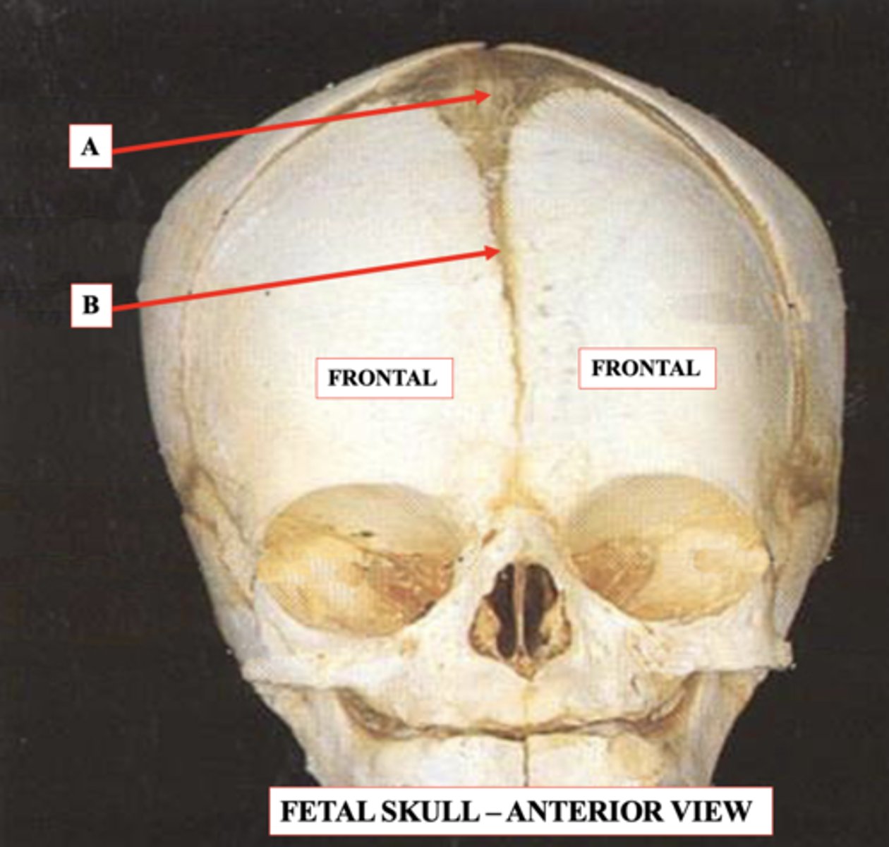 <p>Identify B.</p>