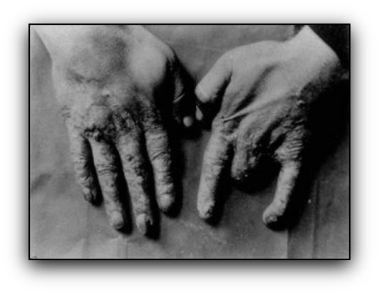 <p>What are some biological effects of X-ray exposure?</p>