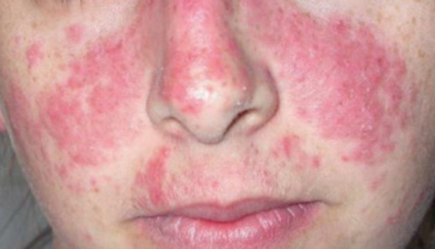 <p>What is the diagnosis?</p>