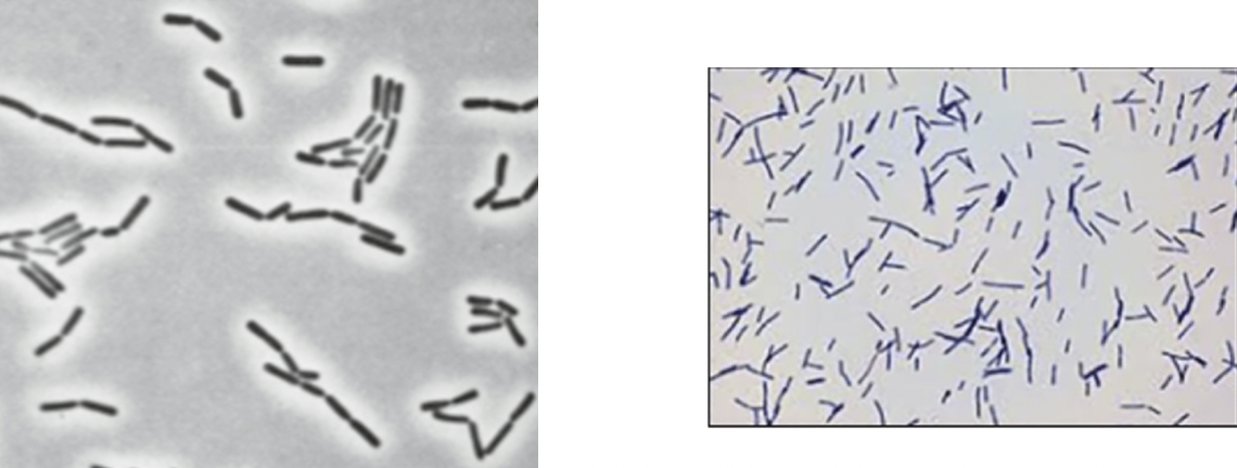 A type of prokaryote bacterium that consumes lactose and converts milk to yogurt, and are rod-shaped chains