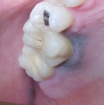 <p>what is the most likely diagnosis </p>