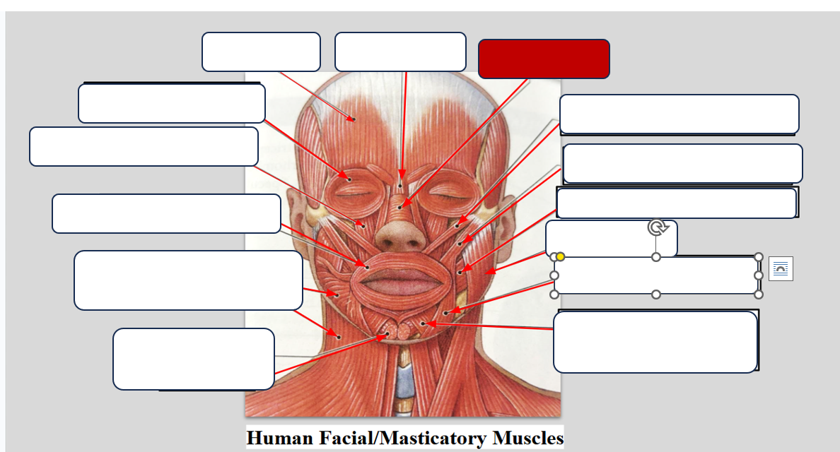 <p>Label the muscle. </p>