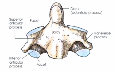 <ul><li><p>Characterized by the <strong>dens</strong> (odontoid process), a strong conical projection from the upper surface of the body that serves as the pivot for head rotation.</p></li><li><p>The dens fits into the anterior arch of the atlas, held in place by the transverse ligament.</p></li><li><p>Superior articular processes articulate with the inferior processes of the atlas.</p></li><li><p>Inferior articular processes are similarly oriented to those of the lower cervical vertebrae.</p></li><li><p>The laminae are broad and thick, while the spinous process is strong and positioned horizontally.</p></li><li><p>The unique structure of the axis and its joints with the atlas allows the head to rotate side to side (“no” motion).</p></li></ul><p></p>