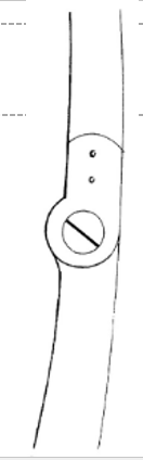 <p>What are indications for this knee joint?</p>