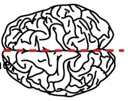 <p>What anatomical plane is this?</p>