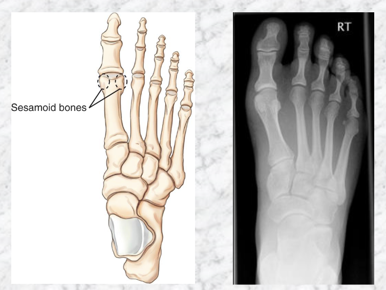 <p>Embedded in tendons</p><p>Present near joints</p><p>Plantar surface of foot</p>
