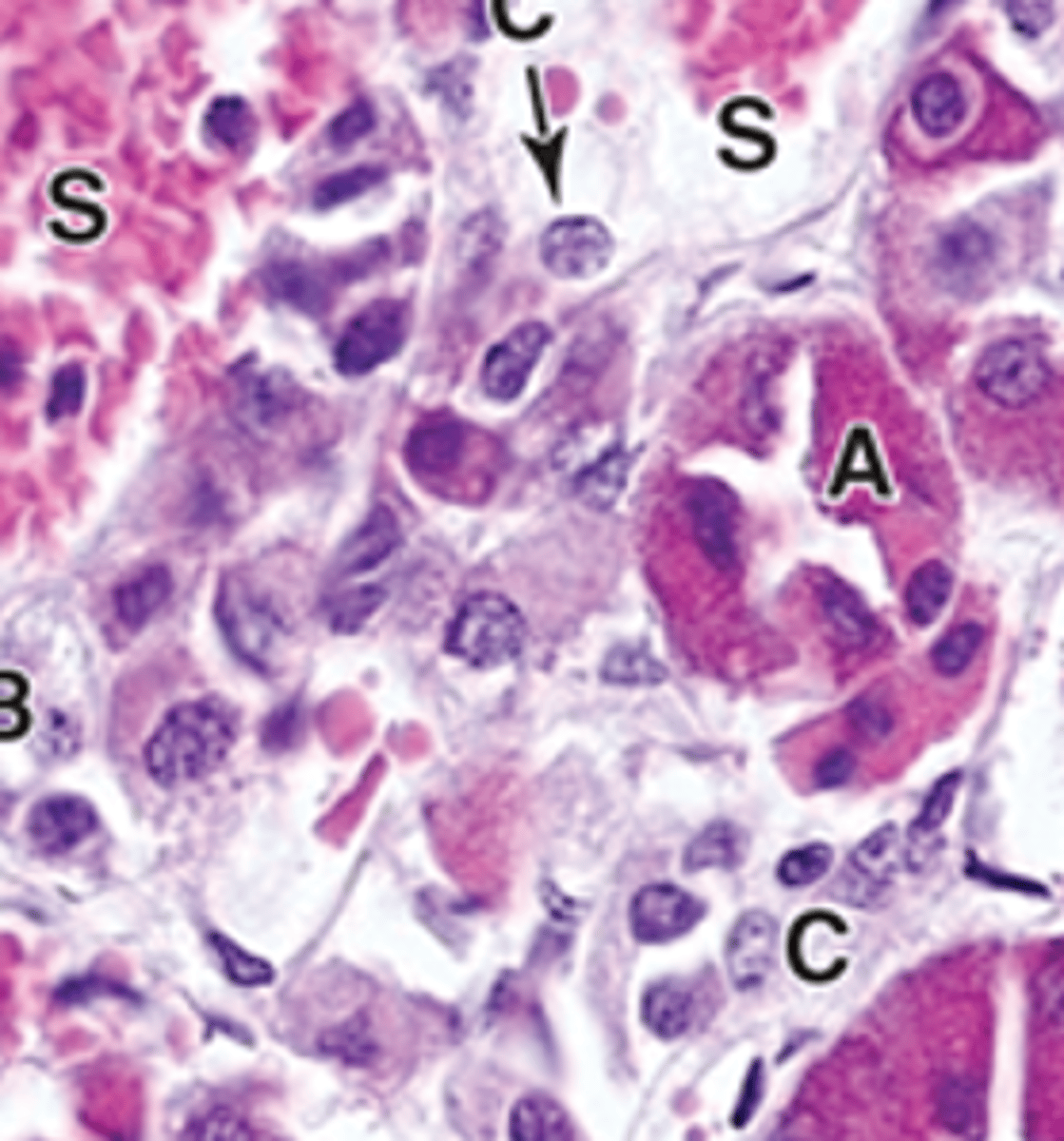 <p>ID C</p>