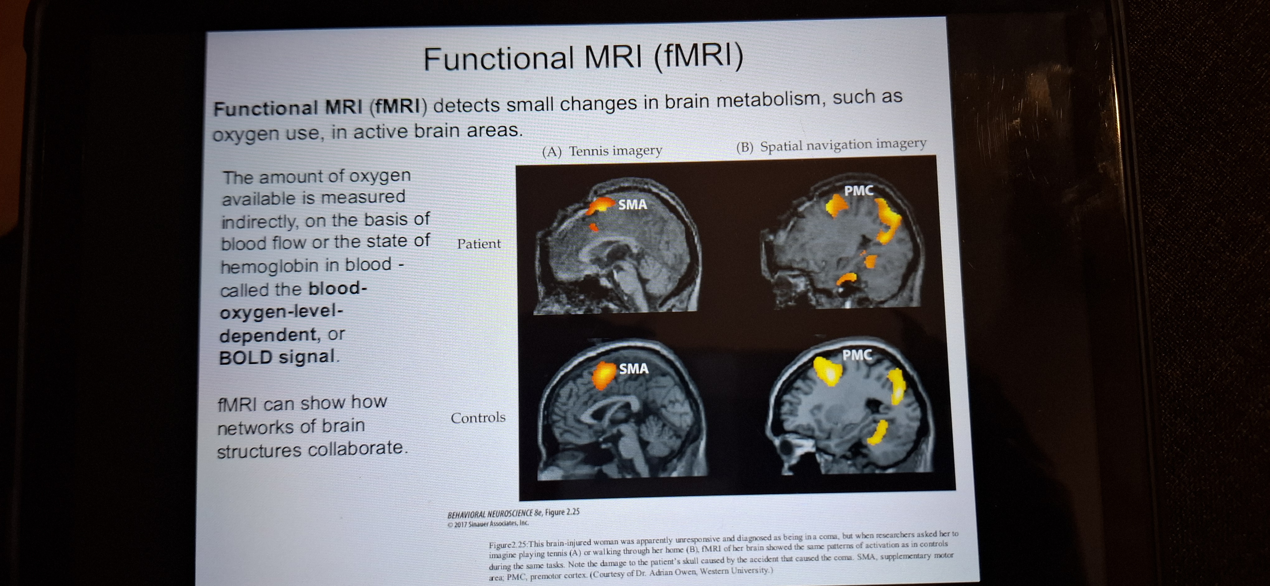 <p>Functional MRI detects small changes in brain metabolism such as oxygen use, in active brain areas.</p>