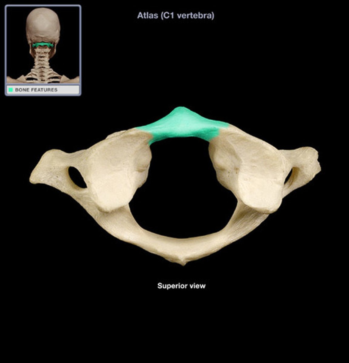 <p>Name this specific part of the atlas (C1).</p>