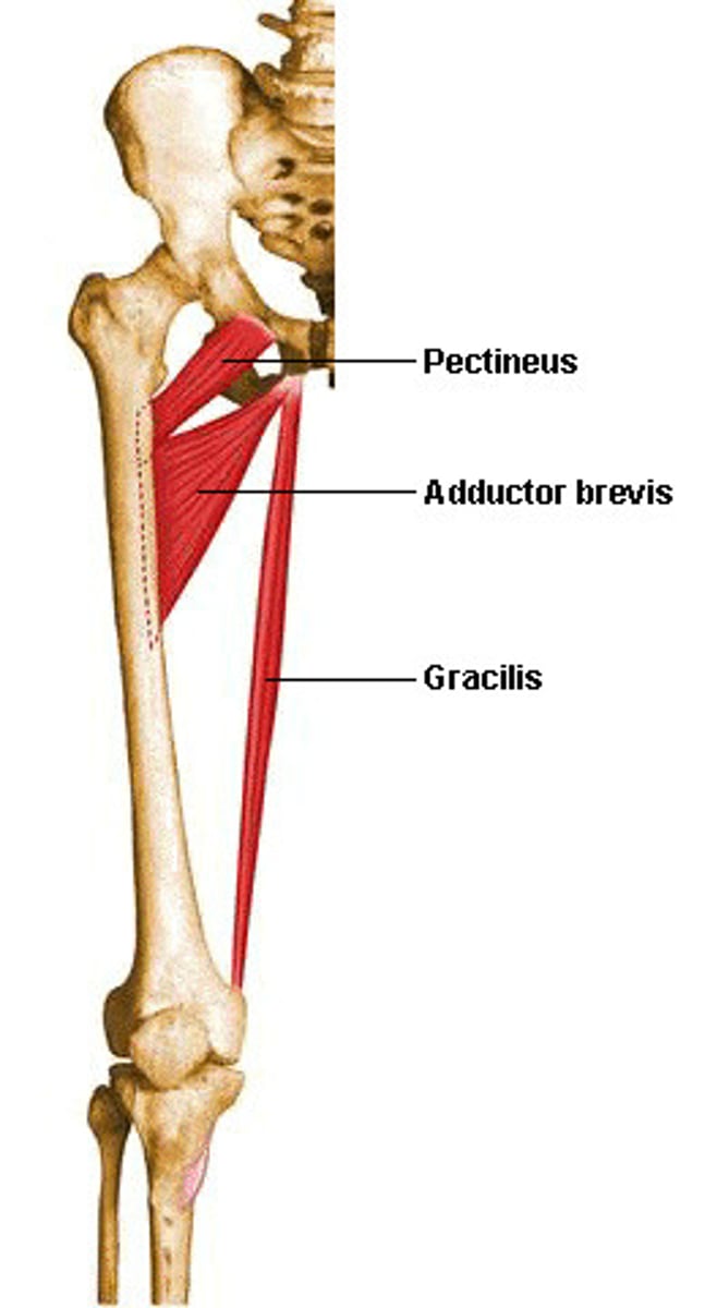 <p>Medial thigh</p><p>Proximal attachment</p><p>- Pubic bone</p><p>Distal attachment</p><p>- Pes anserinus (medial surface of proxmial tibia)</p><p>Innervation</p><p>- Obturator nerve</p><p>Action</p><p>- Hip adduction</p><p>- Knee flexion</p>