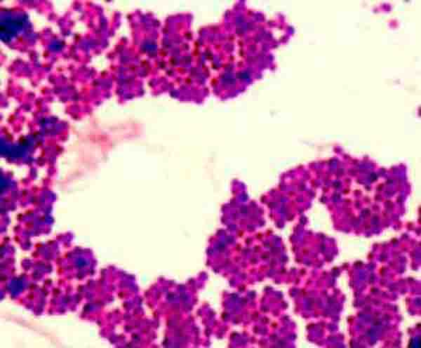 <p>What am I- gram stain, shape, arrangement</p>