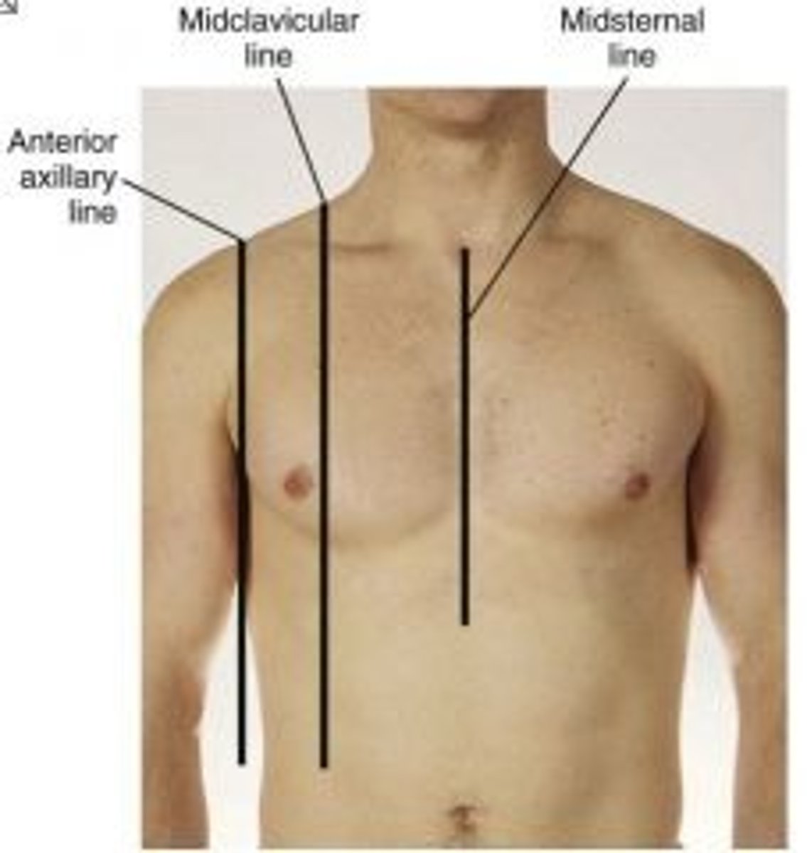 <p>the line through the center of each clavicle</p>